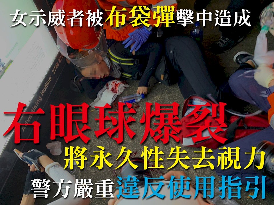 港警射爆女子眼睛 反送中號召百萬人塞爆機場