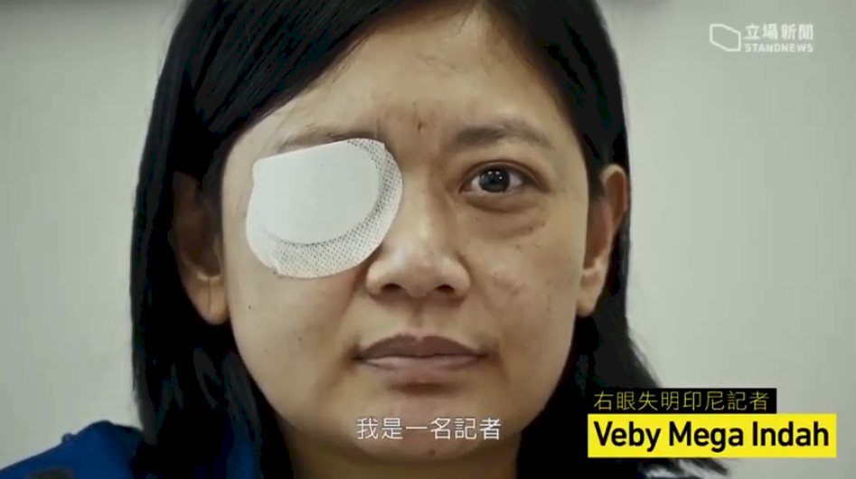 報導反送中右眼失明 印尼女記者尋求正義路迢迢
